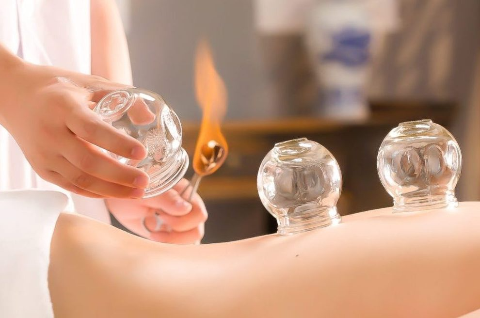 Cupping and Moxibustion illustration